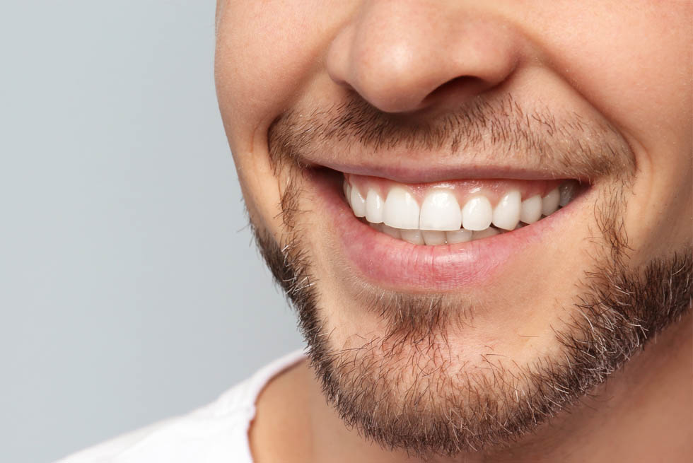 dental inlays and onlays Shildon Smile Care Dental & Implant Centre