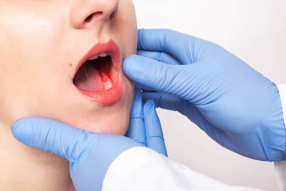 mouth cancer screening at shildon smile care