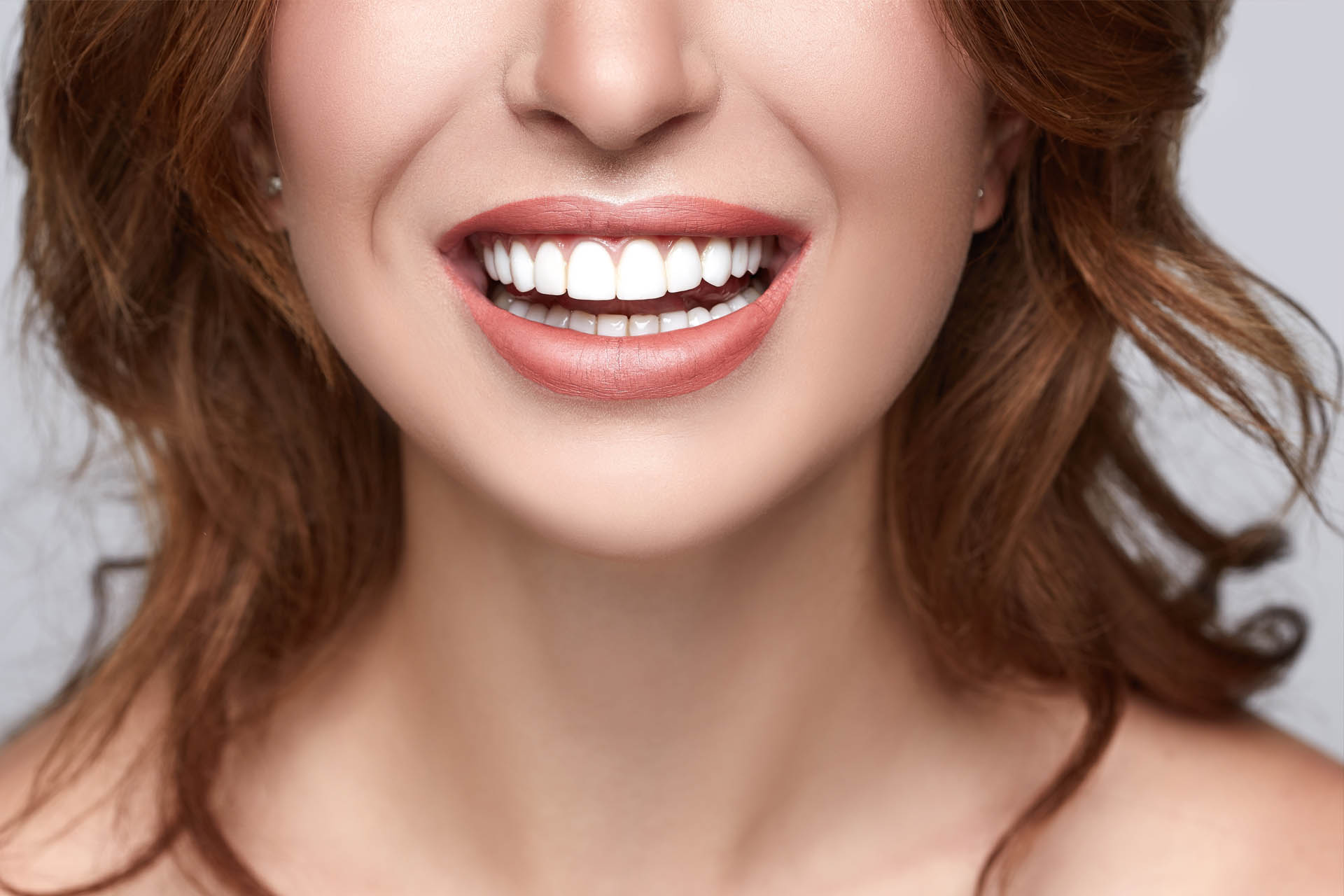 veneers Shildon Smile Care Dental & Implant Centre